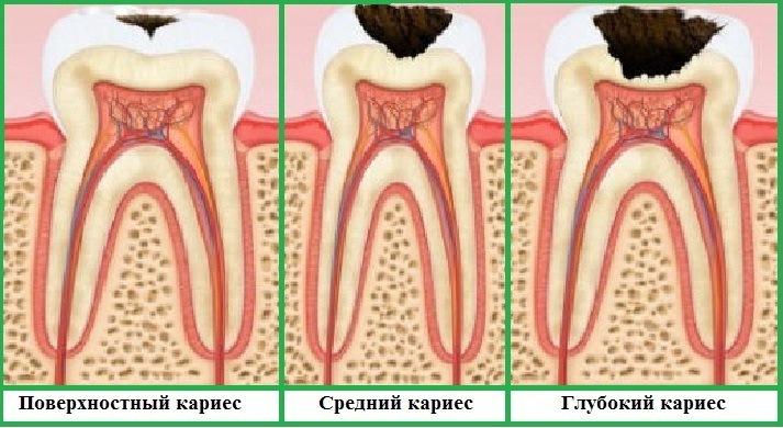 Как избавиться от волос на лобке: 6 методов Как выбрать машинку для маникюра и педикюра? Машинка для