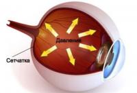 Хирургическое лечение глаукомы